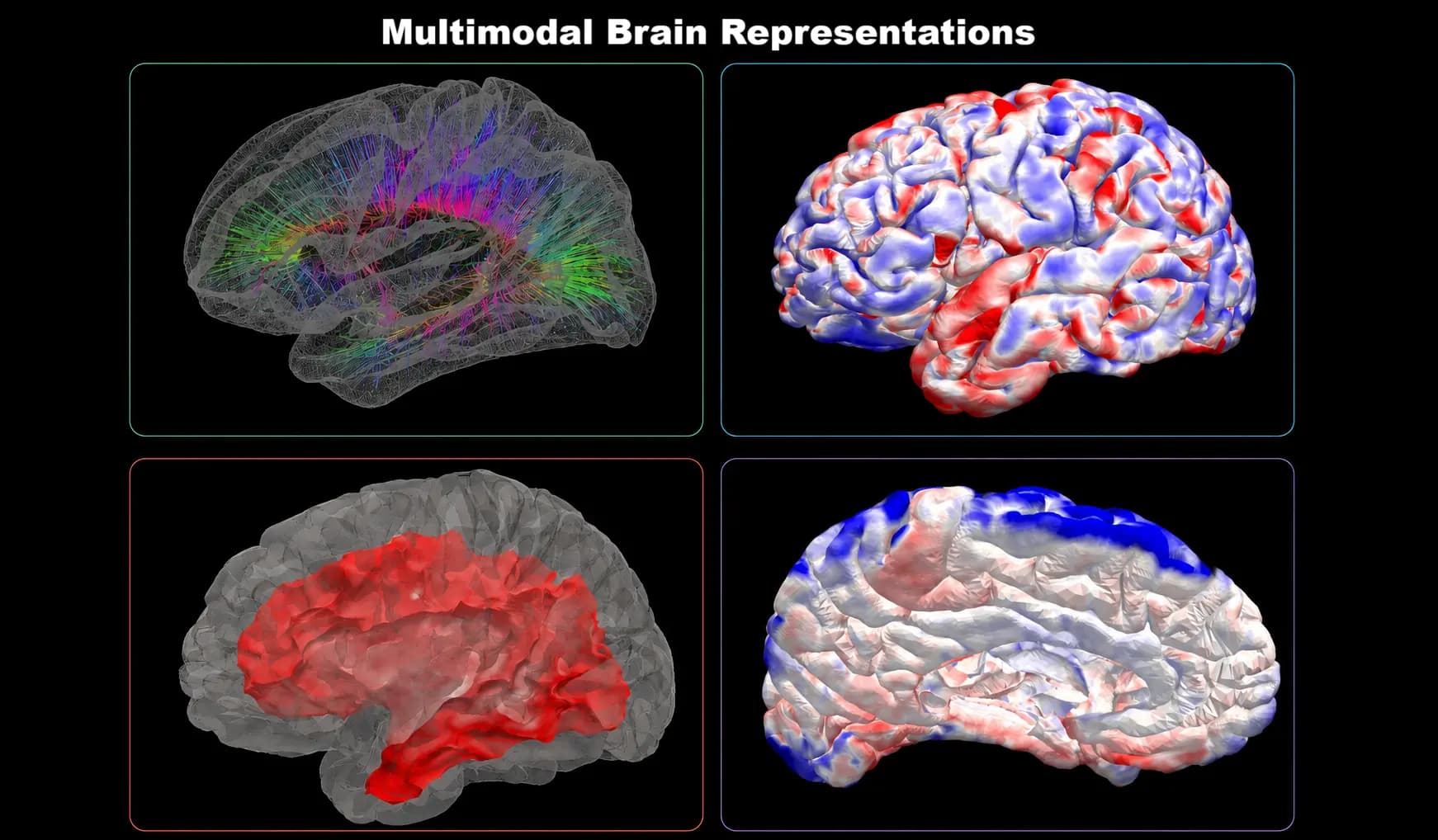 Whole-brain morphometric analysis