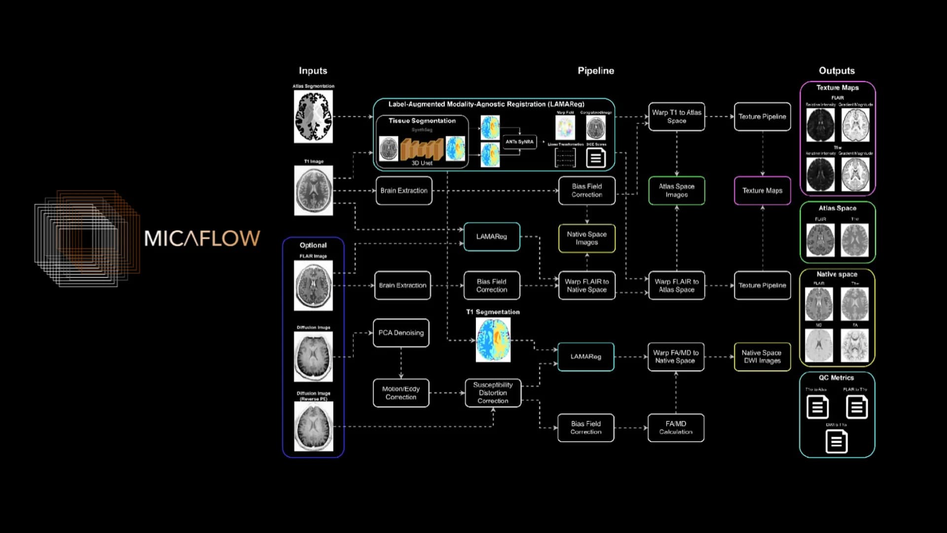 MRI processing pipeline